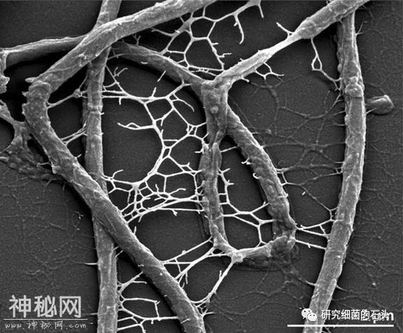 收藏｜56张图片带您认识细菌长啥样？-35.jpg