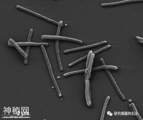 收藏｜56张图片带您认识细菌长啥样？-42.jpg