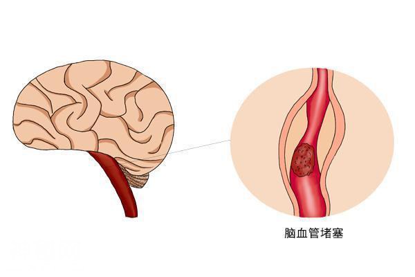 为什么有人睁着眼睡觉？-4.jpg