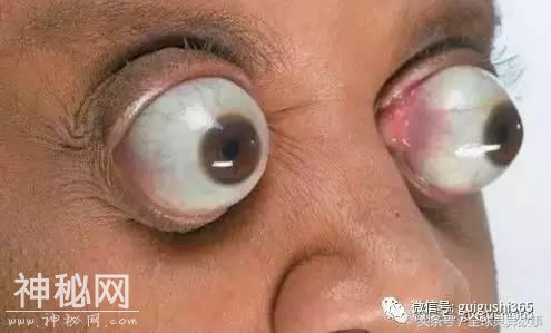 21个恐惊天下人的世界奇人，心脏不好的慎看！-11.jpg