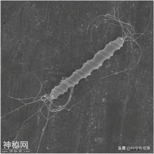 10亿细菌一口闷：马歇尔和幽门螺旋杆菌的不解之缘-4.jpg