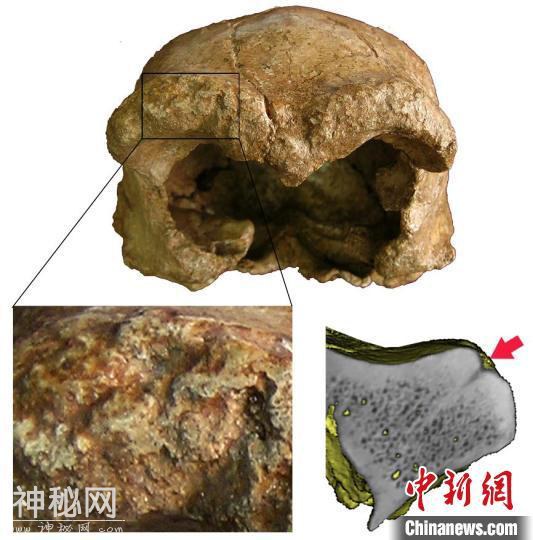 古人类学家研究揭秘：40万年前和县直立人头盖骨发现三类异常痕迹-3.jpg