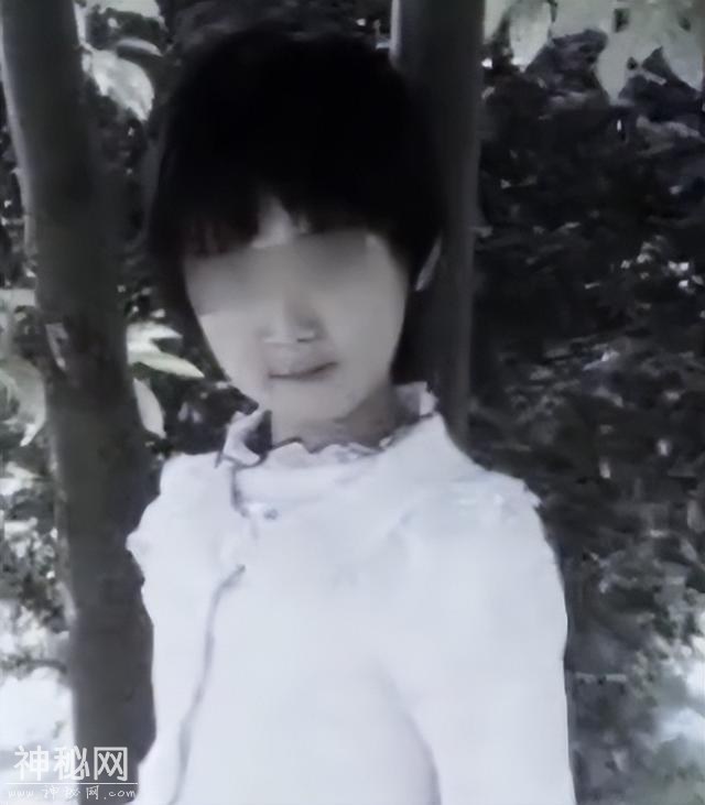 15年武汉8岁女童患怪病，为保命全身移植猪皮，引出离奇身世-12.jpg