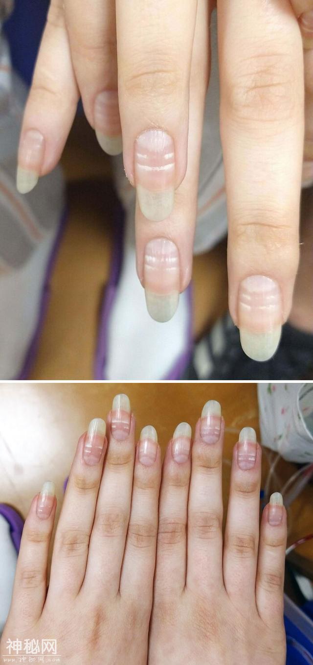 30张奇趣的人体照片：探索身体的神奇与怪异-3.jpg