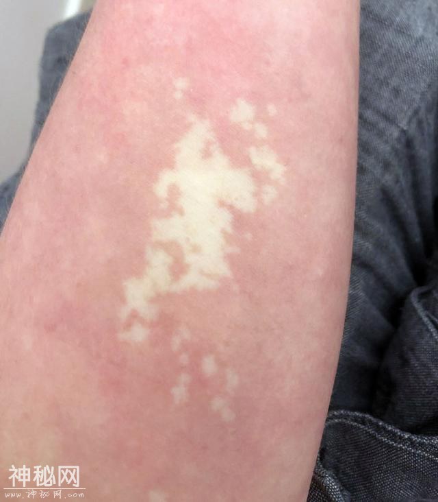 30张奇趣的人体照片：探索身体的神奇与怪异-6.jpg