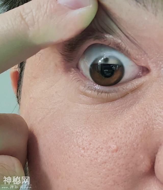 30张奇趣的人体照片：探索身体的神奇与怪异-9.jpg