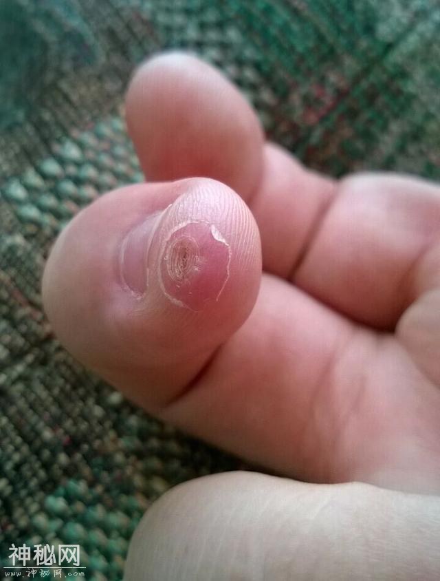 30张奇趣的人体照片：探索身体的神奇与怪异-11.jpg