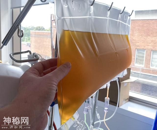 30张奇趣的人体照片：探索身体的神奇与怪异-14.jpg