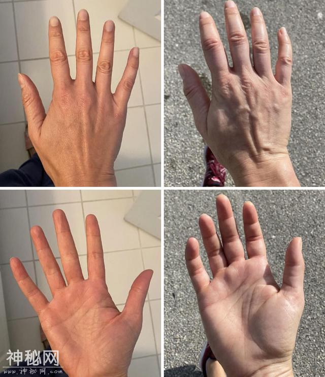 30张奇趣的人体照片：探索身体的神奇与怪异-20.jpg