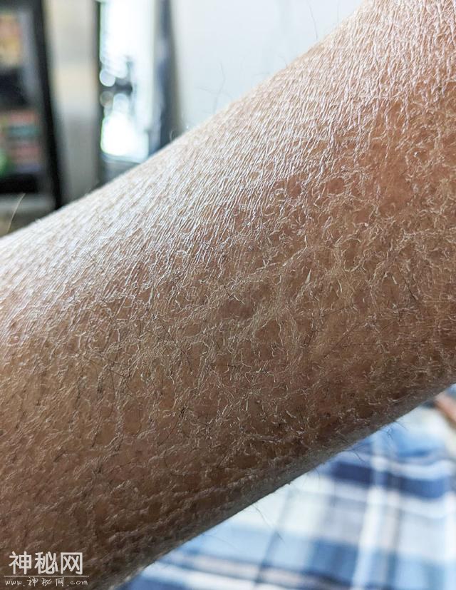 30张奇趣的人体照片：探索身体的神奇与怪异-29.jpg