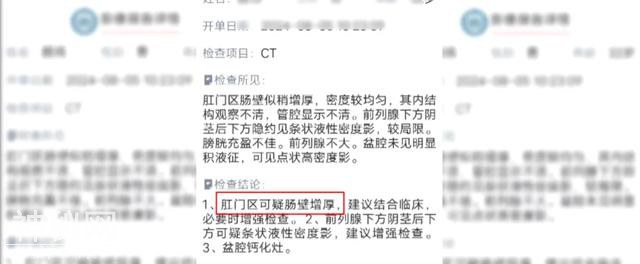 男子患“怪病”，时时刻刻都想上厕所！妻子：他难受得想跳楼-14.jpg