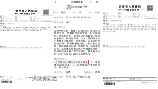 男子患“怪病”，时时刻刻都想上厕所！妻子：他难受得想跳楼-15.jpg