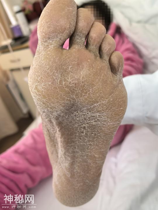 35岁女子突患怪病，一查竟是“砒霜”中毒！-5.jpg