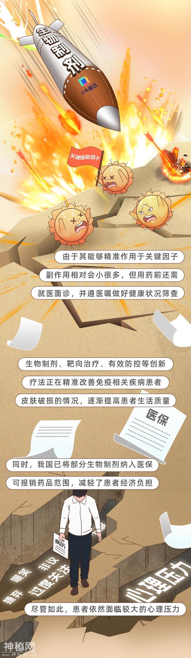 人体最大的器官却常常被忽视？-8.jpg