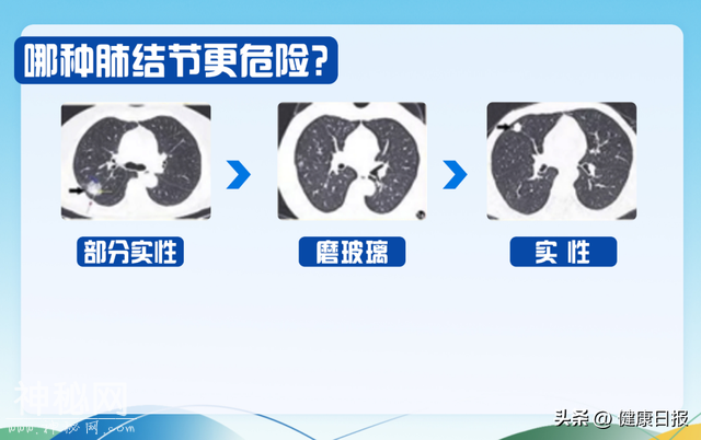 国际肺癌日|魔术大师刘谦宣布抗癌胜利:肺癌并非不可战胜!-5.jpg