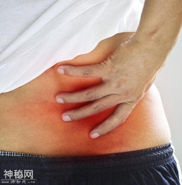 为何总是莫名其妙的发炎？原来不是“病菌”在作怪！是无菌性炎症-1.jpg