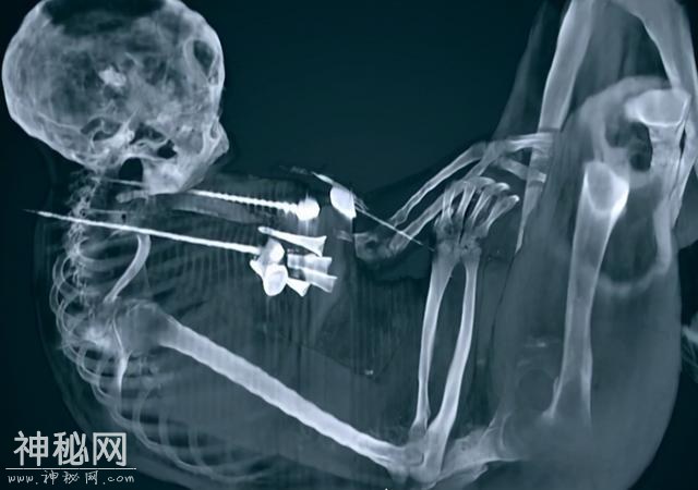 6700米高的雪山上发现古墓，一具被冰封500年的女尸，仿佛在睡觉-7.jpg