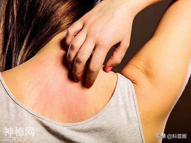 人体诡异的器官：皮肤为什么会莫名“发痒”？科学家至今无法解释-8.jpg