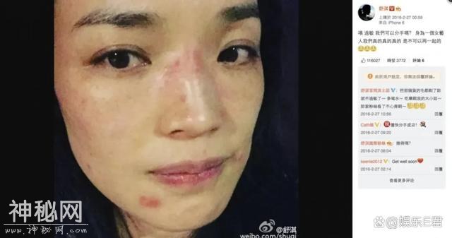 舒淇自曝被传染病毒！-4.jpg