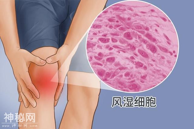 一旦感染终身携带！发作时痛不欲生，超9成人体内潜伏有这种病毒-4.jpg