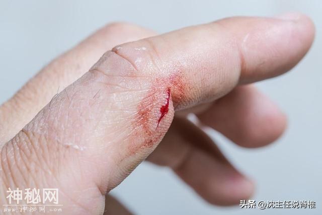 身体出现这5种情况，说明你的免疫力下降了，赶紧对照自查！-2.jpg