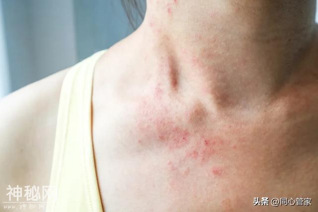 健康警报：身体小症状背后的隐藏危机！-5.jpg